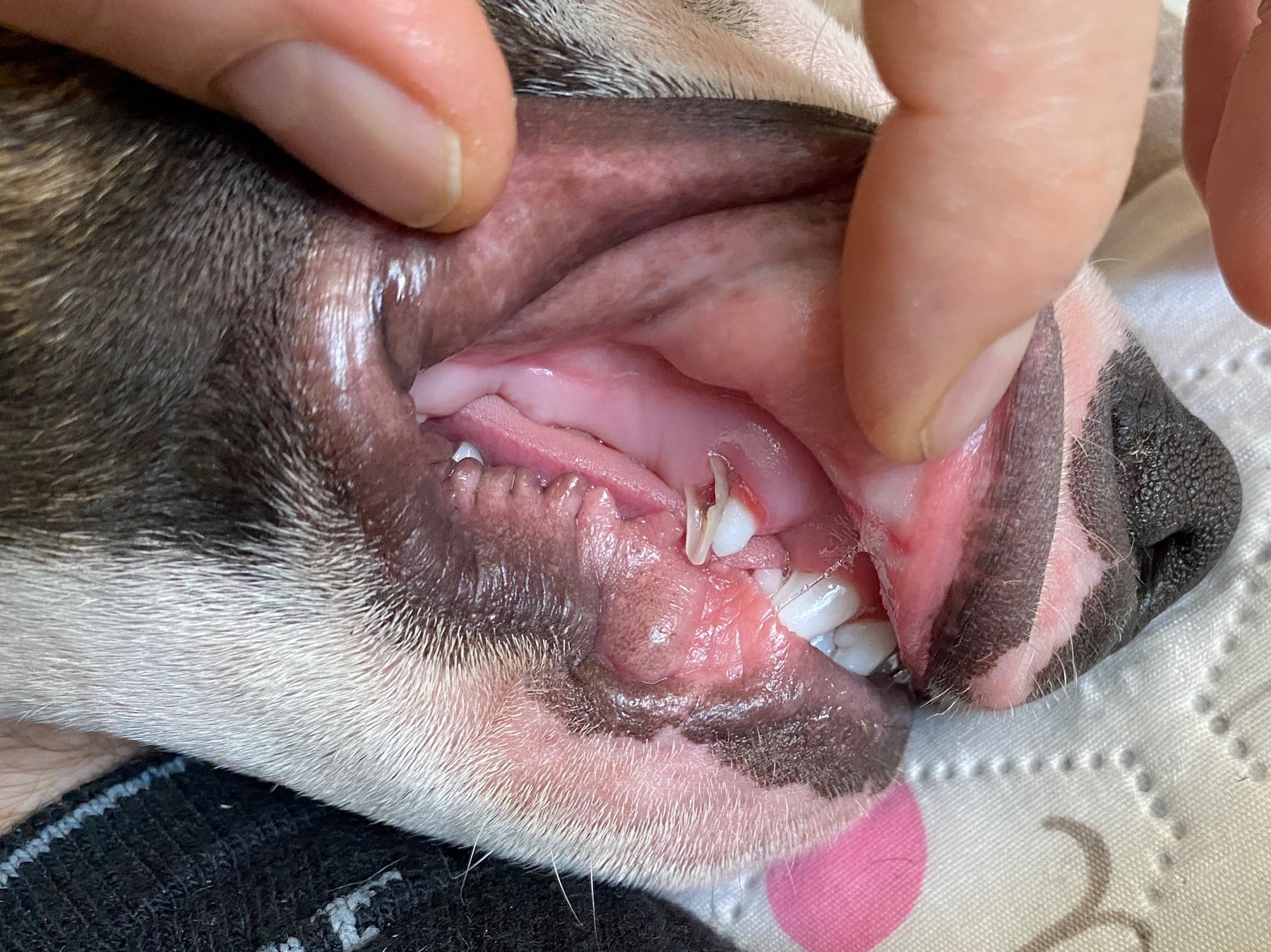 Tooth Check